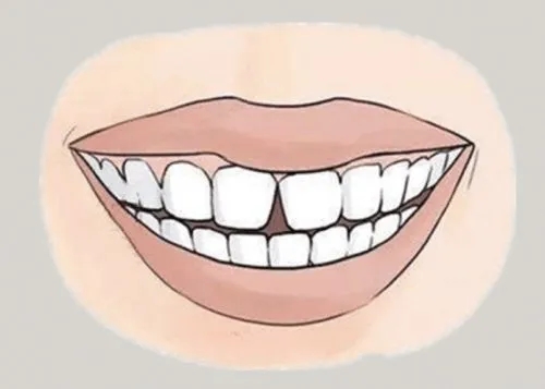 <a href=http://www.mkvu.com.cn/news_article?news_id=116>一次性口腔探針</a>